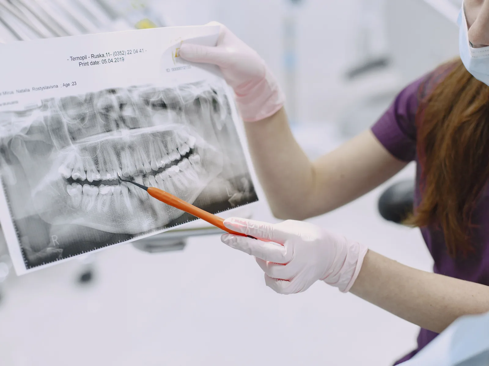 A dentist points to a dental X-ray while explaining it to a patient.